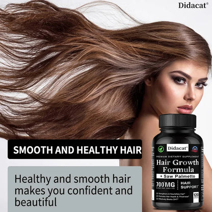 Hair Loss Supplements for Men & Women with Biotin - Saw Palmetto Supplements for Healthy and Strong Hair - Promotes Hair Growth